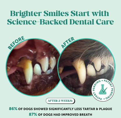 Suvoxe Dental Powder